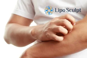 Best Actinic Keratoses Removal 4 prevent your actinic keratoses Salisbury getting worse - call our team today!