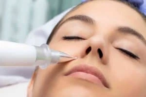 Best Actinic Keratoses Removal 3 Actinic keratoses Salisbury solutions - book in today!