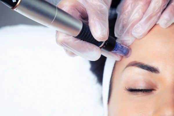 Explaining Total Skin Tightening Treatment and What to Expect 2 What Skin Concerns Can Total Skin Tightening Treatment Help With Salisbury?